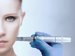 Microneedling